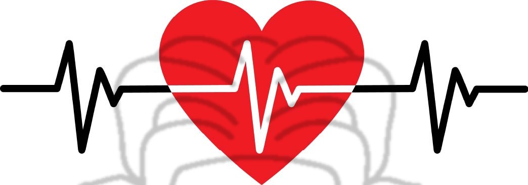 EKG