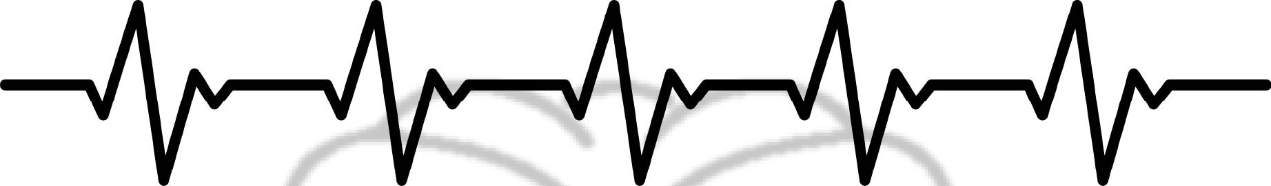 EKG